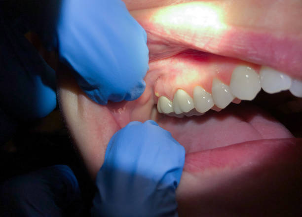 Best Cracked Tooth Emergency Dentist  in Calera, OK