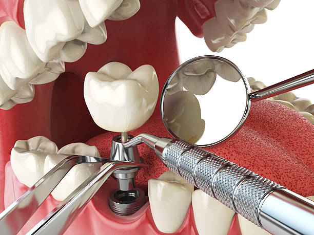 Best Broken Tooth Emergency  in Calera, OK