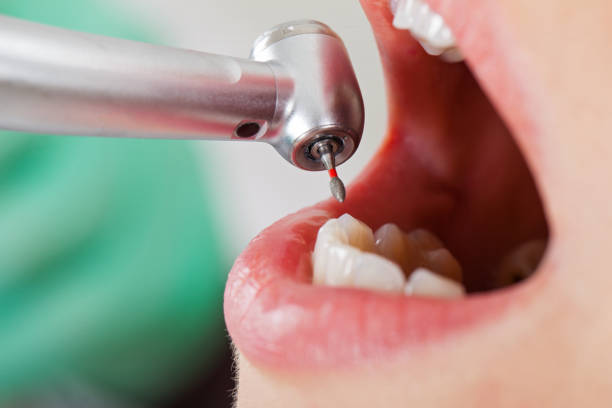 Best Tooth Infection Emergency Dentist  in Calera, OK